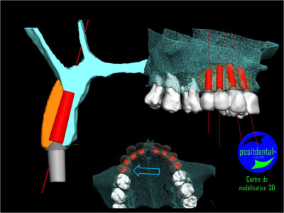 Image17 fpvu4d - Eugenol