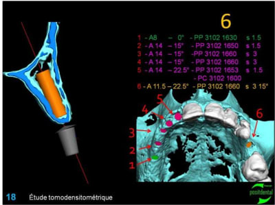 Image18 cic7nt - Eugenol