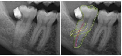 Image1 sfycwl - Eugenol