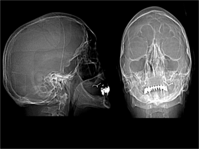 Image1 thqy6r - Eugenol