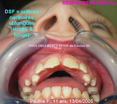 Image1 xgcwtm - Eugenol