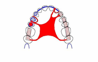 Image20 vdkgg7 - Eugenol