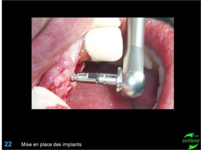 Image22 qzeenv - Eugenol