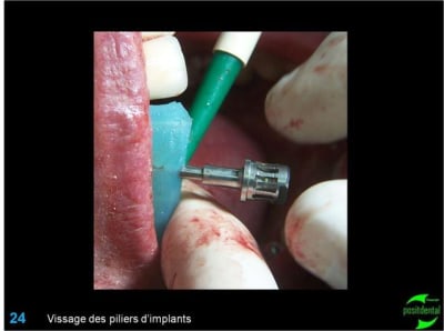 Image24 vwldjr - Eugenol