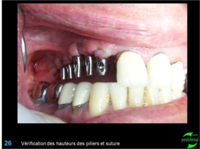 Image26 p6bb0p - Eugenol