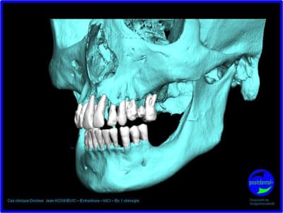 Image2 ejetny - Eugenol