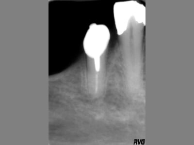 Image2 myolzq - Eugenol
