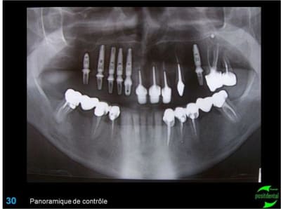 Image30 aavmsl - Eugenol