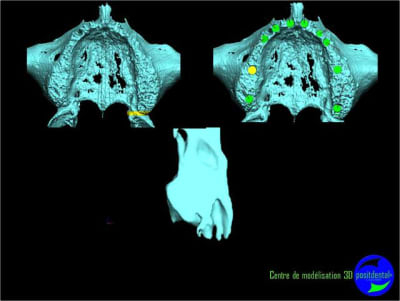 Image30 wds7v6 - Eugenol