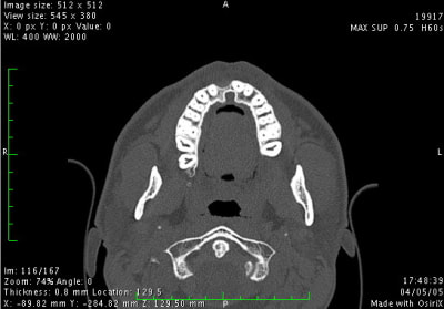 Image3 btt7m9 - Eugenol