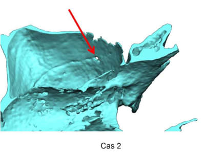 Image3 cozdrw - Eugenol