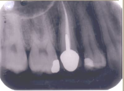 Image3 npbnep - Eugenol