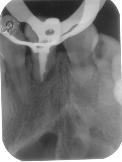 Image3 xwhtzw - Eugenol