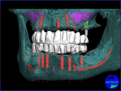 Image4 slqkvu - Eugenol