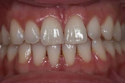 Image5 joj2md - Eugenol