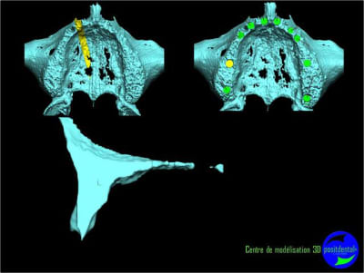 Image5 lhoshd - Eugenol