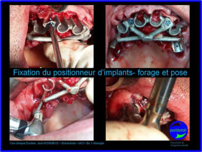 Image5 xtz9kz - Eugenol