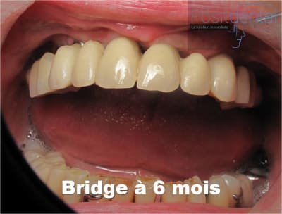 Image6 ngs9jg - Eugenol