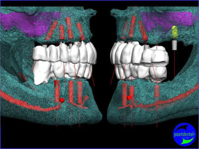 Image6 z1eqku - Eugenol