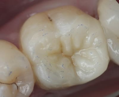 Image7 avrle9 - Eugenol