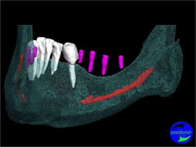 Image8 q3nkgj - Eugenol