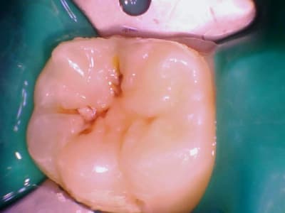 Image 001 kjcpvd - Eugenol