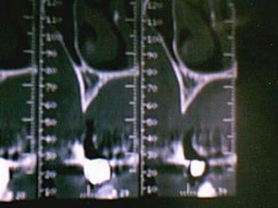 Image 002 u1agru - Eugenol