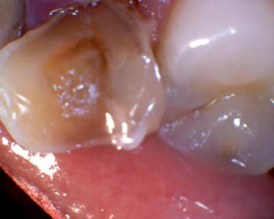 Image 115 ycaoxi - Eugenol