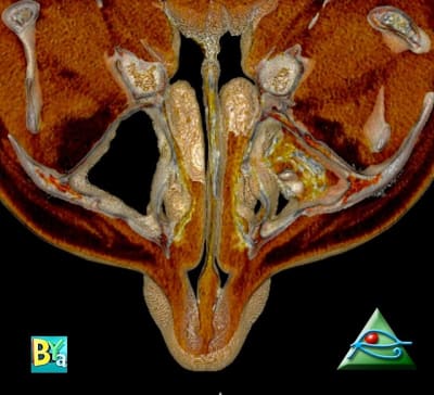 Image 1 wfp8zv - Eugenol