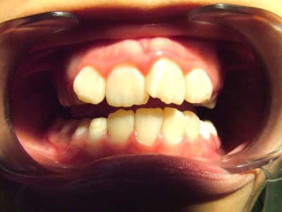 Image 2 ugqmmy - Eugenol