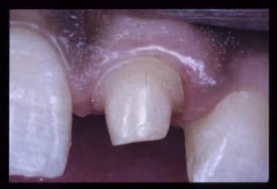 Image centr 2 hugyw7 - Eugenol