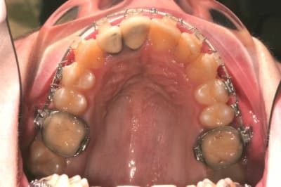 Img 4584 ywthil - Eugenol