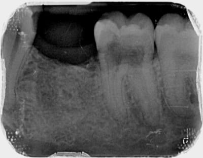 Inconnu x 20141103 164329 xvlrzwmnq8hw 4 mo5ci2 - Eugenol