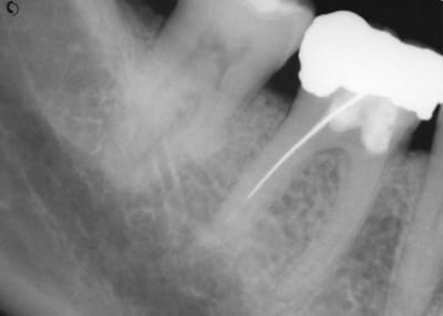 Jc1 utcnhi - Eugenol