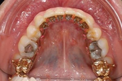 J   9 mois v0estz - Eugenol