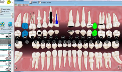 Julie dent absente 3 imr5fc - Eugenol