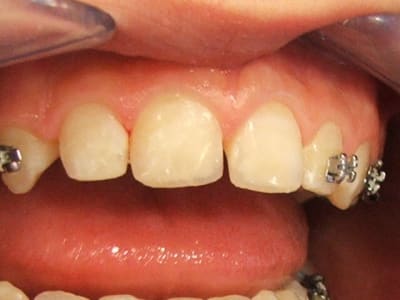 Julien après gqxh55 - Eugenol