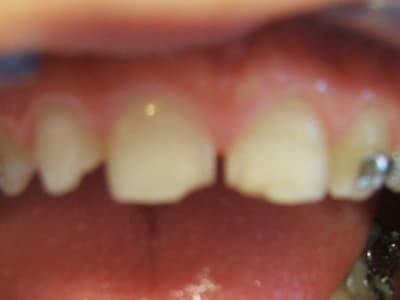 Julien avant y92cgz - Eugenol