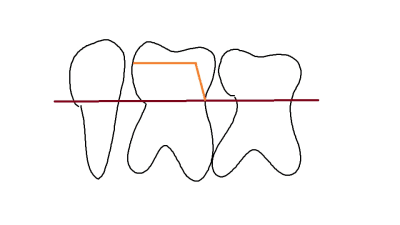 L art dentaire xiz7oc - Eugenol
