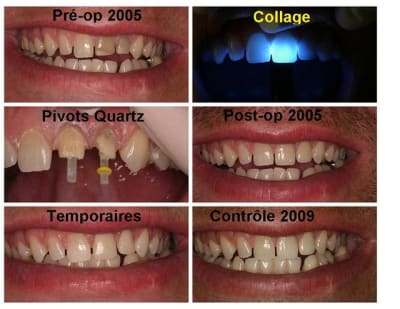 Lauzon montage 2009 c  mno8nb - Eugenol