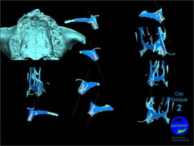 Mcd mise en charge diff r e04 zuoide - Eugenol