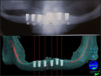 Mcd mise en charge diff r e11 rn0wke - Eugenol