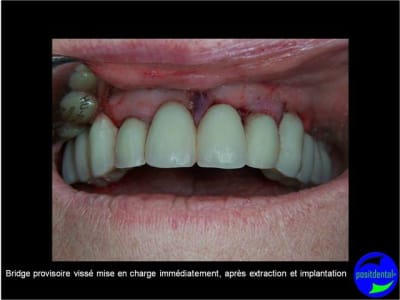Mci - Eugenol