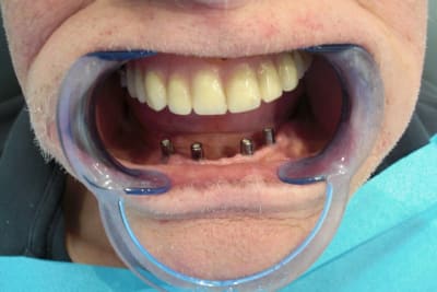 Mci6mois ftqnuc - Eugenol