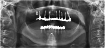 Mci max axwnsl - Eugenol