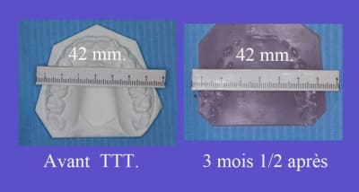 Mesures dcz9sn - Eugenol