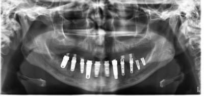 Mise en charge   8 jours xnzyml - Eugenol