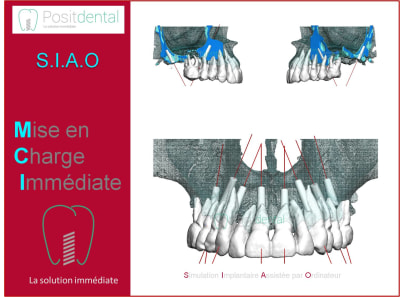 Mise en charge immédiate 003 vyddzz - Eugenol