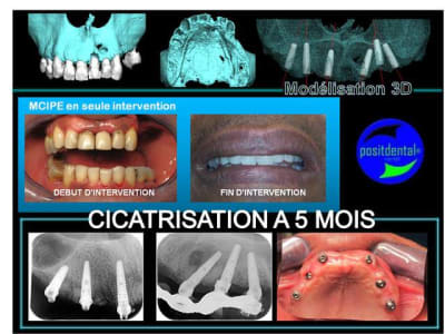Mise en charge instantan e gqr9bo - Eugenol