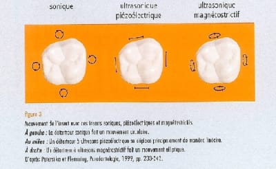 Mouvements ultrasons rplzlk - Eugenol